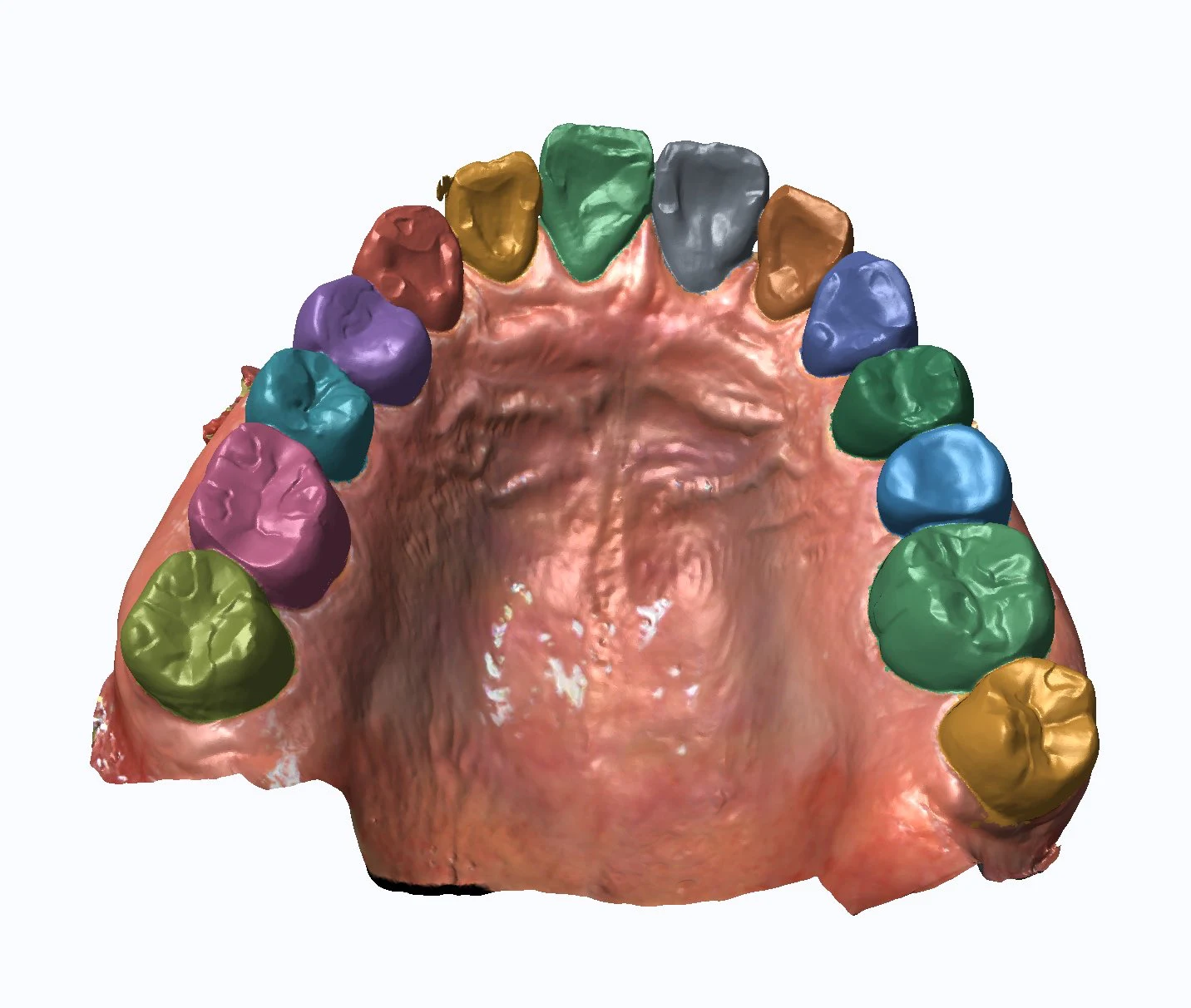 ToothGroupNetwork（TGNet）で歯を1本ずつ色分けした口腔内スキャンの3Dモデル